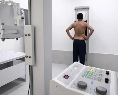 X ray 15